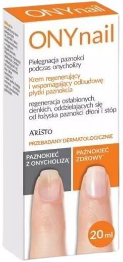 Recenzja kremu do paznokci ONYnail 20 ml